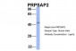 PRPSAP2 Antibody - N-terminal region